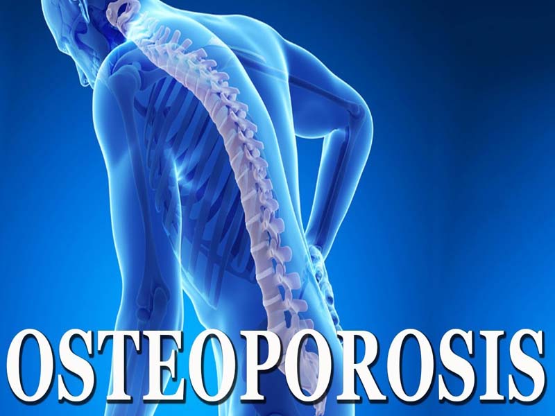 osteoporosis